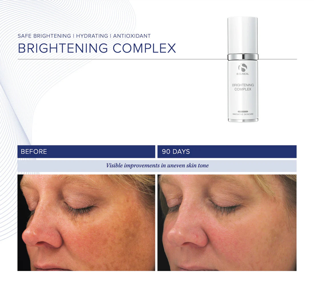 Brightening Complex