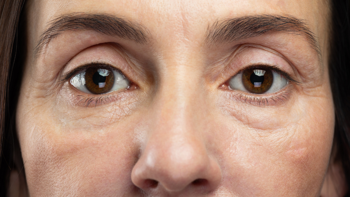 Contours des yeux
